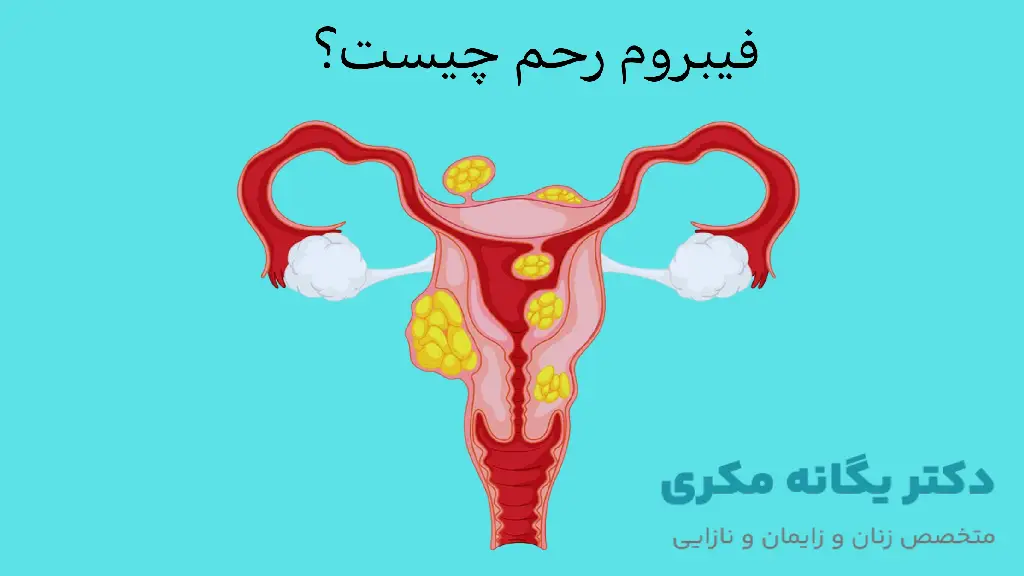 فیبروم رحم چیست؟