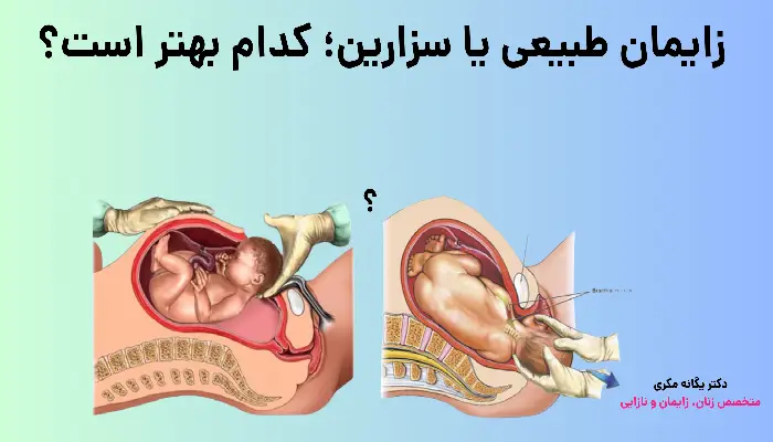 زایمان طبیعی یا سزارین؛ کدام بهتر است؟