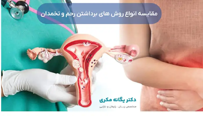 مقایسه انواع روش های برداشتن رحم و تخمدان